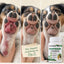 YeastGuard results timeline across three stages of a dog's recovery
